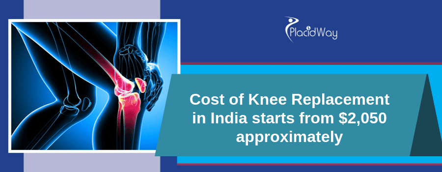 Knee Replacement in India